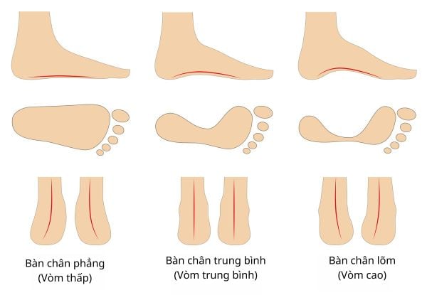 Các kiểu bàn chân và cách chọn giày