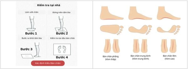 Các kiểu bàn chân và cách xác định