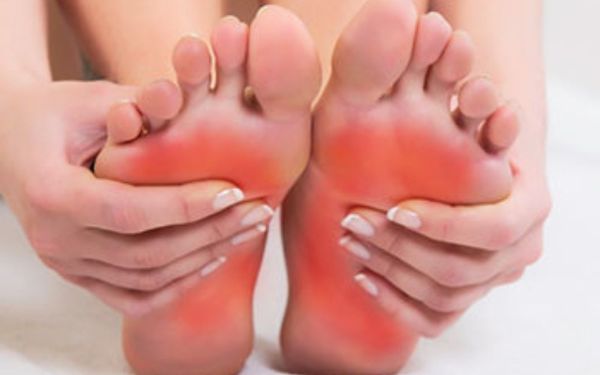 Viêm cân gan chân dẫn đến đau lòng bàn chân, đau gót chân, đau mũi chân