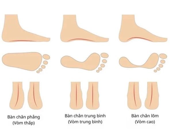 Kiểu bàn chân