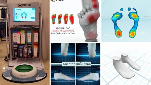 Người có bàn chân bẹt thường bị đau chân: viêm cân gan chân, viên gân achilles, đau gót chân, đau đầu gối...