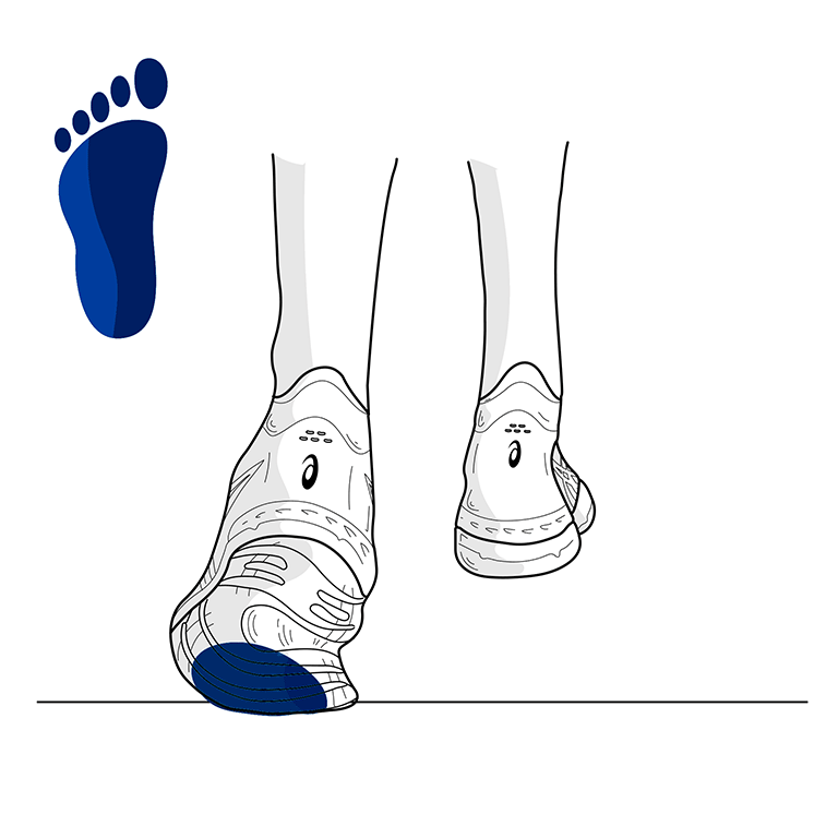 Cách chạy của người có bàn chân bẹt