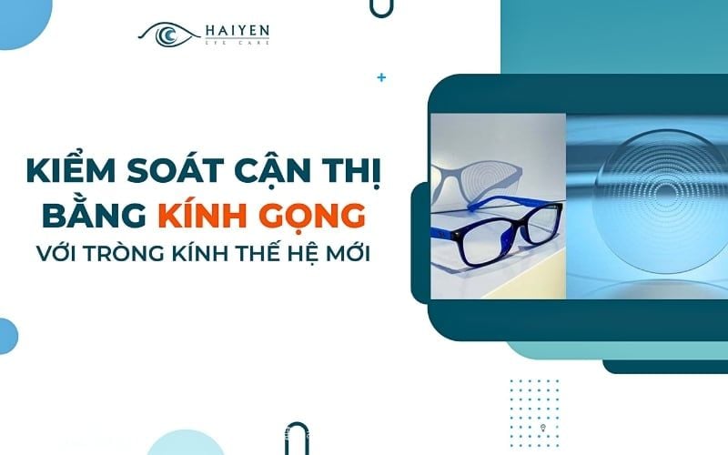 Kiểm soát cận thị bằng kính gọng với tròng kính thế hệ mới