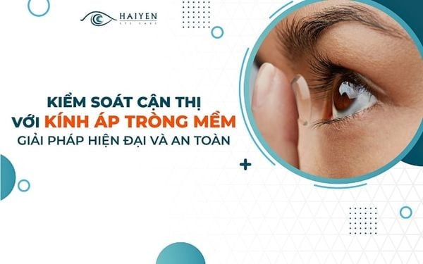 Kiểm soát cận thị với kính áp tròng mềm