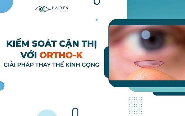 Kiểm soát cận thị với kính Ortho-K - Giải pháp thay thế kính gọng