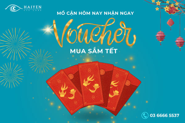 MỔ CẬN HÔM NAY - NHẬN QUÀ VỀ TAY