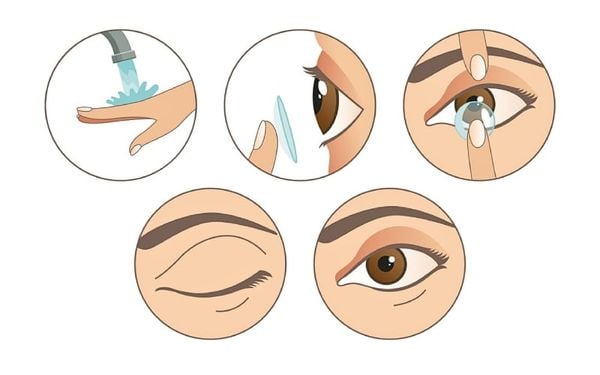 Quy trình vệ sinh kính áp tròng mềm