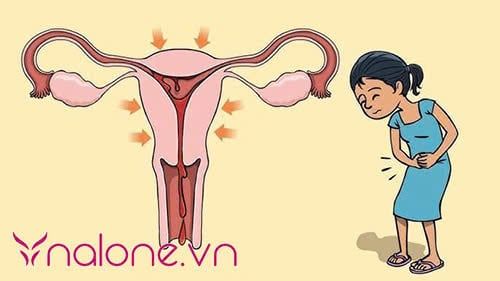 Nữ giới tại sao đến tháng bụng lại to ra?