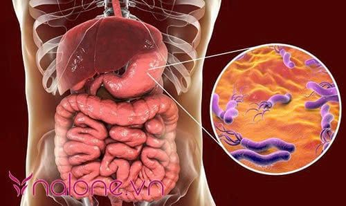 Vi khuẩn Hp có gây hôi miệng không? Helicobacter pylori là gì?