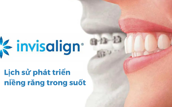 Lịch sử của khay niềng răng trong suốt Invisalign và khuynh hướng của tương lai.