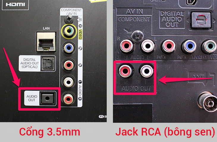 ket noi loa keo voi tivi hat karaoke 5