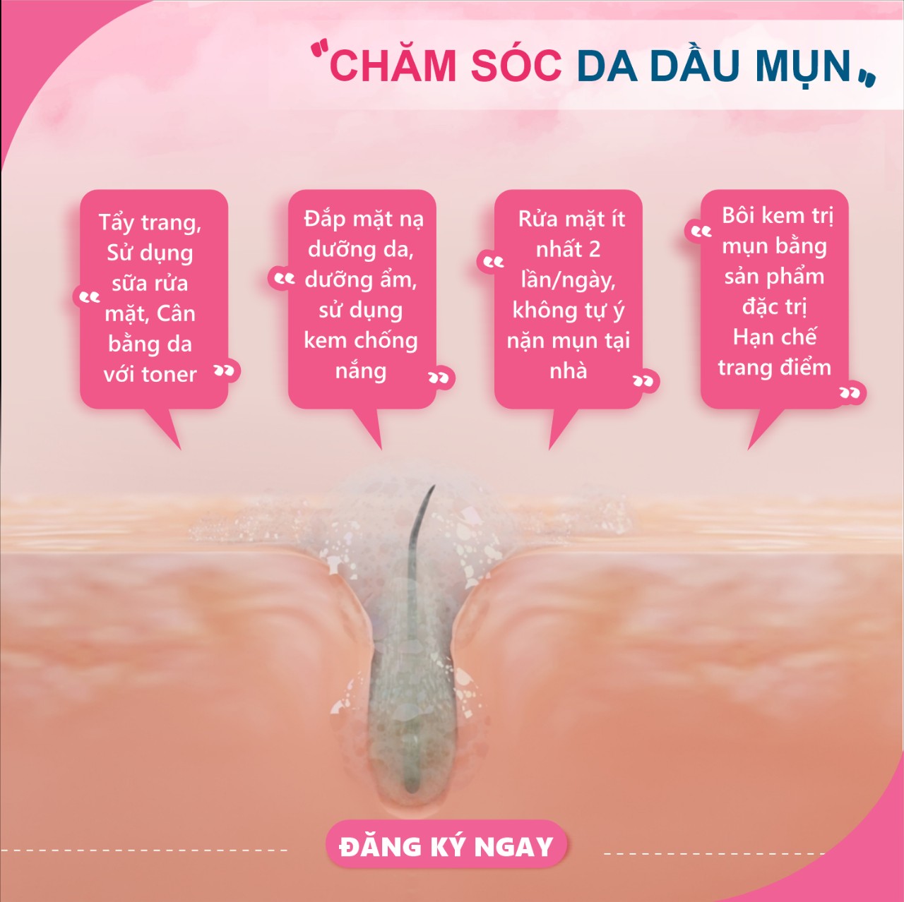 Chăm Sóc Da Dầu Mụn Từ A - Z Cùng Trang Pap Spa