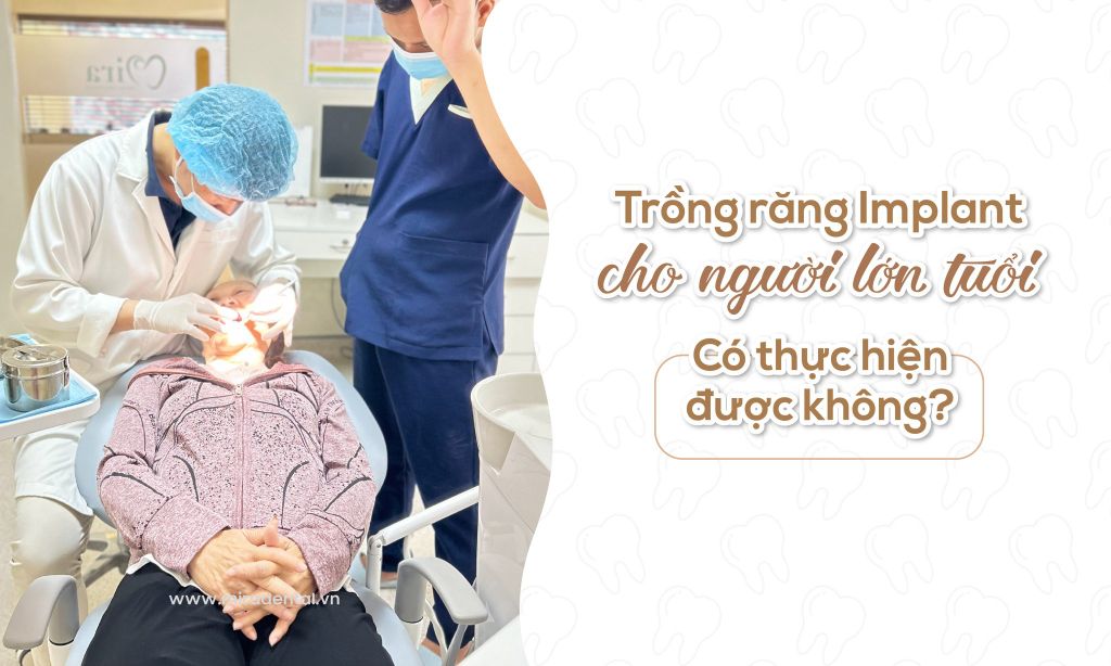 Trồng răng Implant cho người lớn tuổi – Có thực hiện được không?