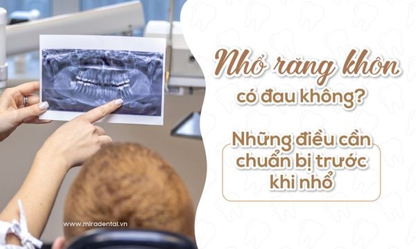 Nhổ răng khôn có đau không? Những điều cần chuẩn bị trước khi nhổ