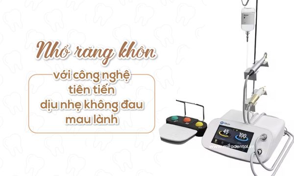 Nhổ răng khôn không đau tại Nha khoa Mira: Công nghệ tiên tiến, bác sĩ chuyên nghiệp