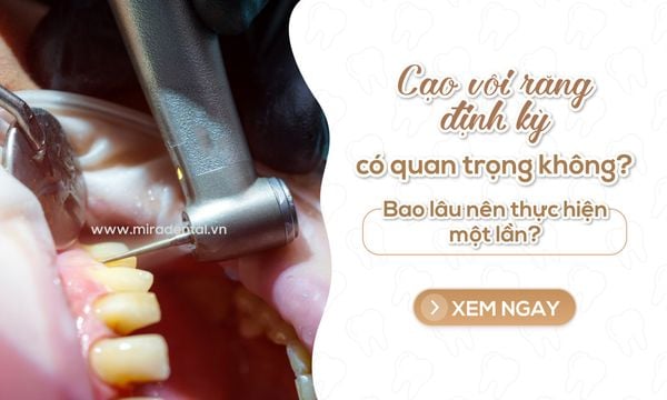 Cạo vôi răng định kỳ có quan trọng không? Bao lâu nên thực hiện một lần?
