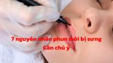 7 nguyên nhân chính phun môi bị sưng