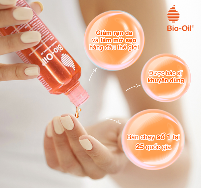 Dầu trị rạn da Bio Oil