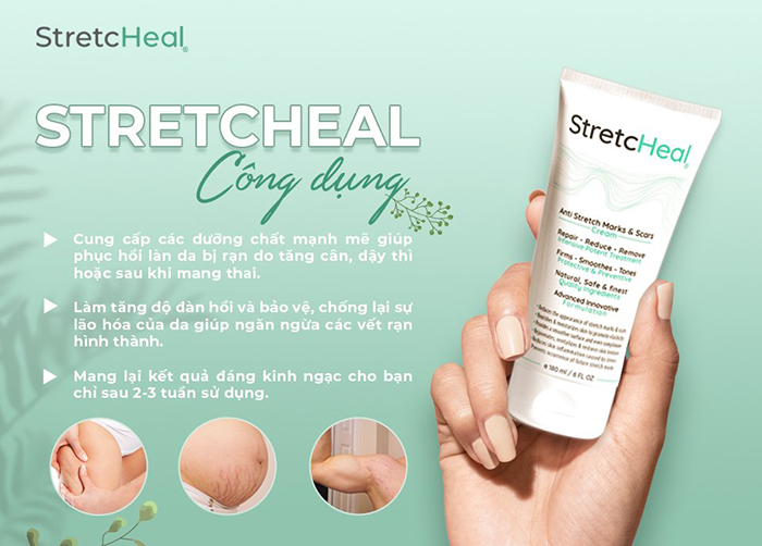 Kem trị rạn da StretcHeal