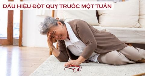 Dấu Hiệu Đột Quỵ Trước 1 Tuần