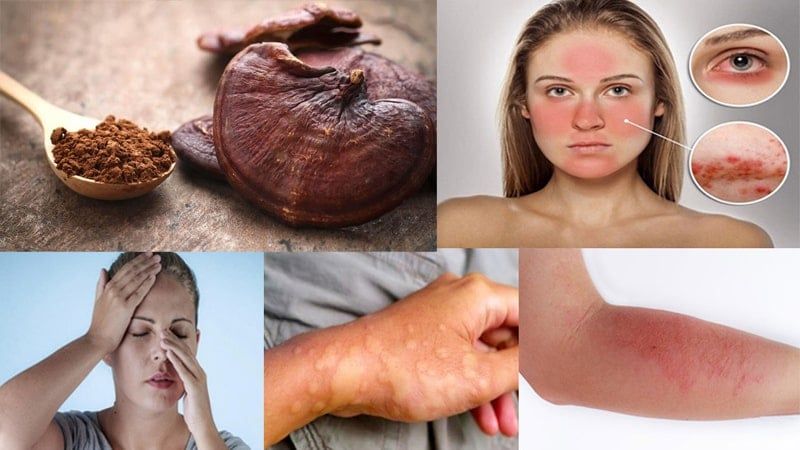 Lưu ý khi sử dụng Nấm Linh Chi