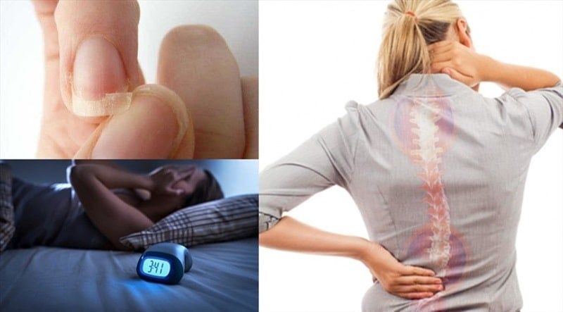 Người bị thiếu canxi, loãng xương