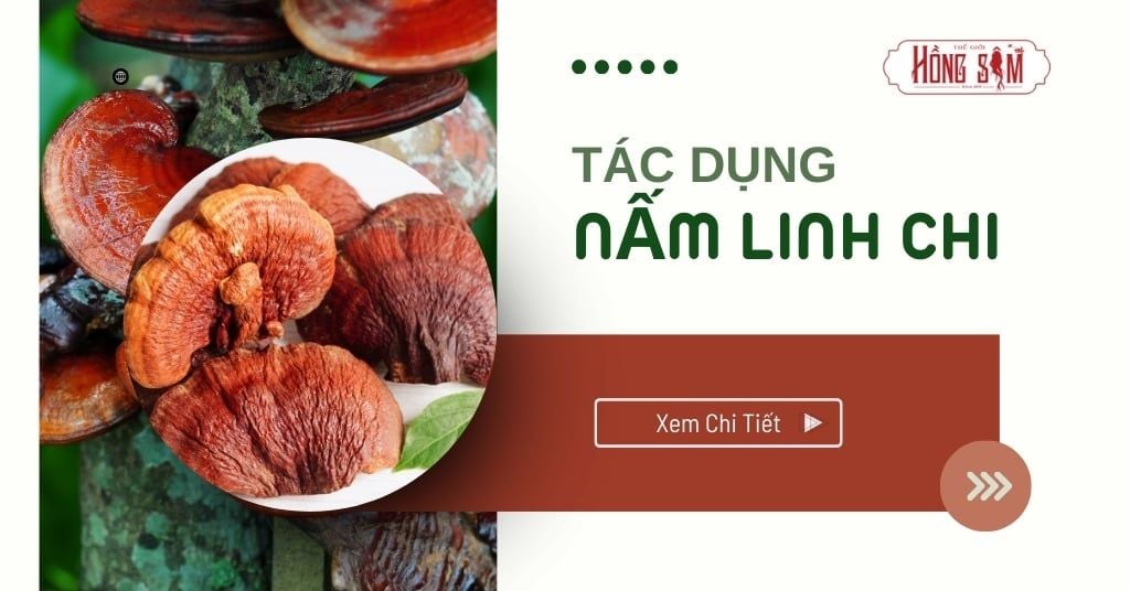 Hình ảnh bài viết
