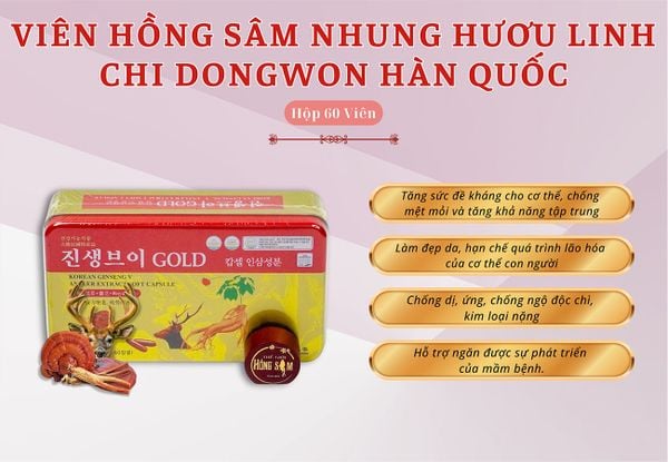 Hình ảnh bài viết