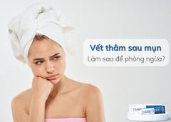 CÁCH CHĂM SÓC VẾT THÂM SAU MỤN AN TOÀN VÀ HIỆU QUẢ TẠI NHÀ