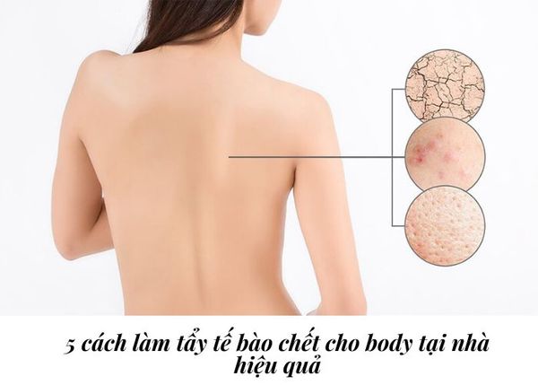 [Bật mí] 5 cách làm tẩy tế bào chết cho body tại nhà hiệu quả