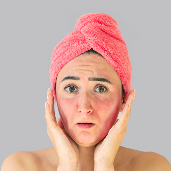 Da mặt bị ngứa châm chích phải làm sao