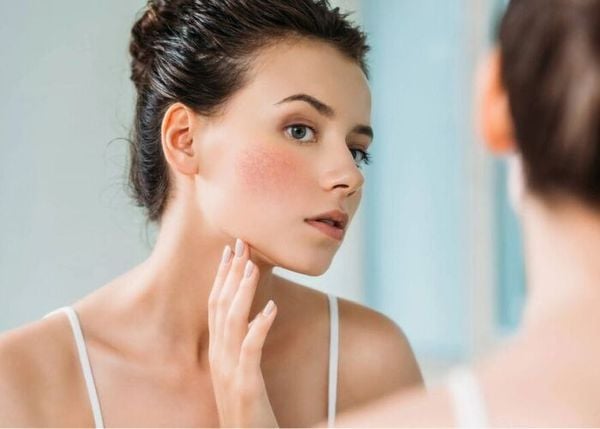 Bôi kem dưỡng ẩm bị nóng mặt có sao không?