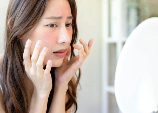 Bôi kem dưỡng ẩm bị rát mặt có sao không