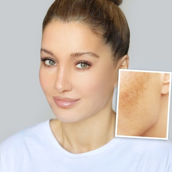 [Giải đáp] Đi nắng da bị đen có trắng lại được không? 7 cách làm trắng da hiệu quả!