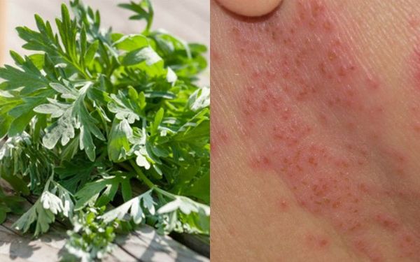 Làm Đẹp Bằng Ngải Cứu: Bí Quyết Toàn Diện Cho Làn Da Khỏe Đẹp