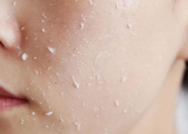 Tẩy Tế Bào Chết Đúng Cách Là Như Nào? 5 Sai Lầm Cần Tránh