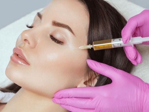 Hướng dẫn chi tiết cách chăm sóc da sau khi cấy máu tự thân