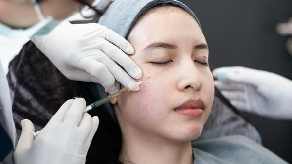 Các giai đoạn phục hồi của da sau cấy máu tự thân và những dấu hiệu bình thường