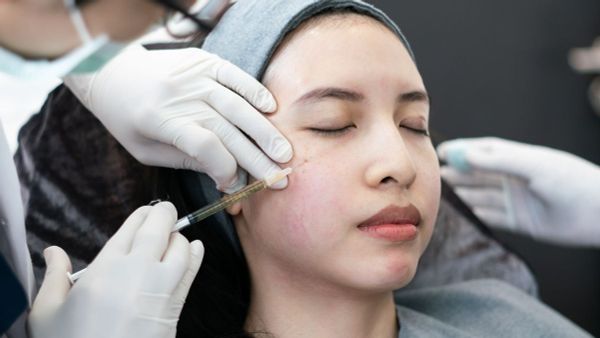 Quy trình PRP và những cảm giác cần lưu ý