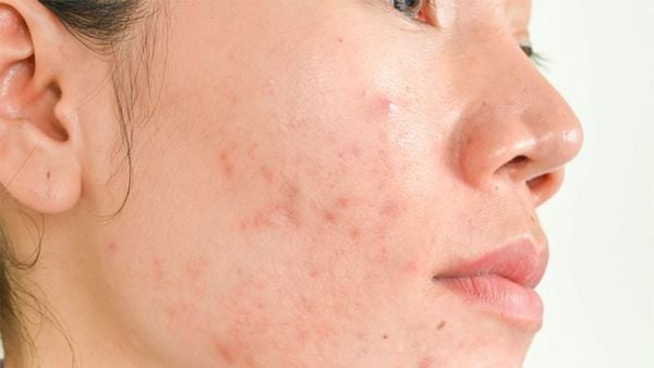 Nguyên nhân dẫn đến việc dùng mỹ phẩm không hợp