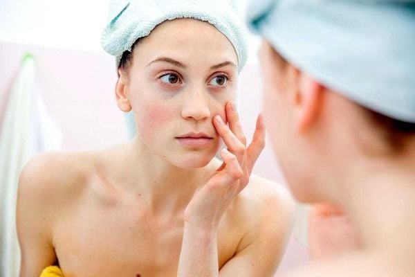 Dấu hiệu kích ứng tức thì: Khi da phản ứng ngay lập tức