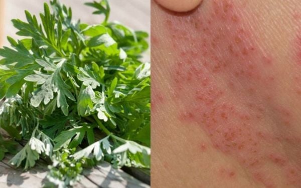 Các hoạt chất chính trong ngải cứu có lợi cho da