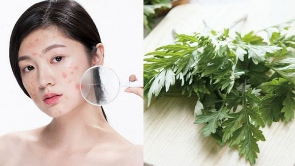 Lợi ích của ngải cứu đối với làn da