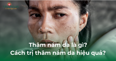 Thâm nám da là gì? Cách trị thâm nám da hiệu quả