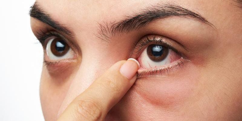 Tìm hiểu bệnh đau mắt đỏ truyền qua đường nào?