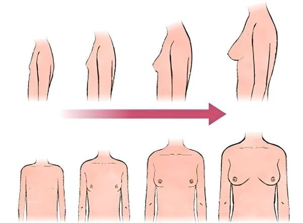 dấu hiệu ngực phát triển