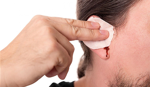 LẤY RÁY TAI BỊ CHẢY MÁU CÓ SAO KHÔNG? CÁCH XỬ LÝ ĐÚNG