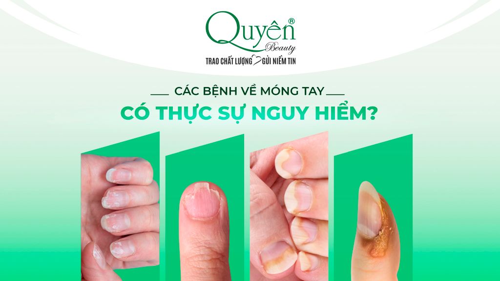 🤔 Các bệnh về móng tay: Có thật sự nguy hiểm? 😲