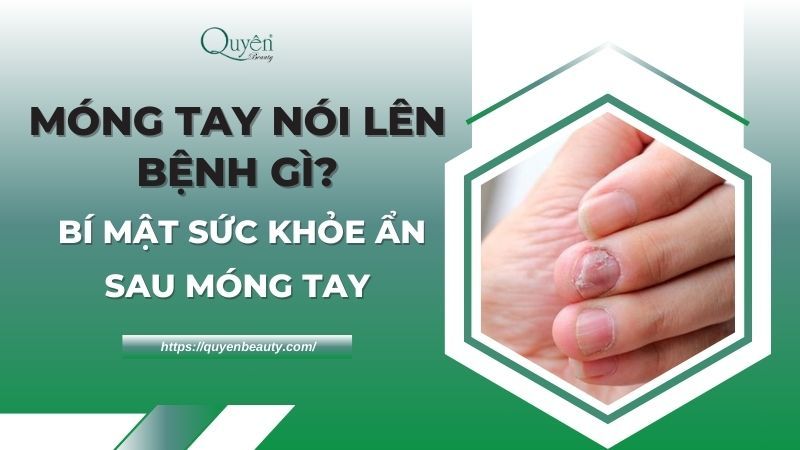 Móng tay nói lên bệnh gì? Bí mật sức khỏe ẩn sau móng tay