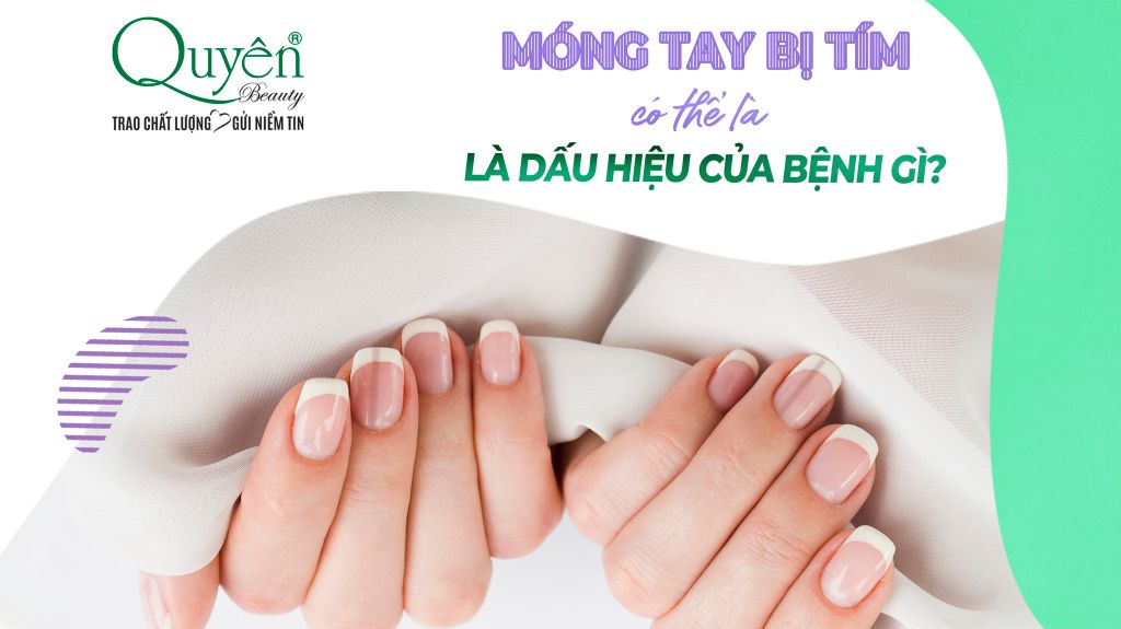 ✨MÓNG TAY BỊ TÍM CÓ THỂ LÀ DẤU HIỆU CỦA BỆNH GÌ?
